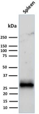 Western Blot: HLA DRB1 Antibody (LN-3 + HLA-DRB/1067) [NBP2-45316]