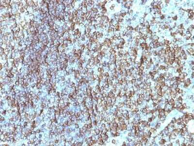 Immunohistochemistry-Paraffin: HLA DRB1 Antibody (SPM288) [NBP2-45312]