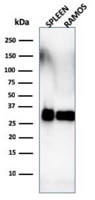 Western Blot: HLA DRB1 Antibody (SPM288) [NBP2-45312]