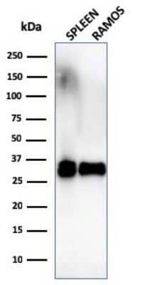 Western Blot: HLA DRB1 Antibody (SPM289)Azide and BSA Free [NBP2-34756]