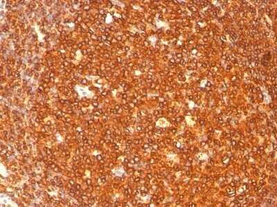 Immunohistochemistry-Paraffin: HLA DRB1 Antibody (SPM289) - IHC-Prediluted [NBP2-48113]