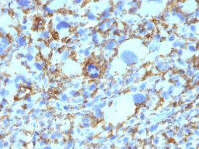 Immunohistochemistry-Paraffin: HLA DRB1 Antibody (SPM423) - IHC-Prediluted [NBP2-48123]