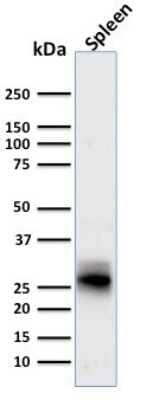 Western Blot: HLA DRB1 Antibody (SPM423) [NBP2-45313]