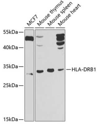 Western Blot: HLA DRB1 AntibodyBSA Free [NBP3-03666]