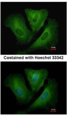 Immunocytochemistry/ Immunofluorescence: HLA DRB3 Antibody [NBP1-33666]