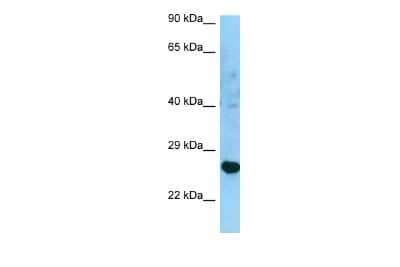 Western Blot: HLA DRB3 Antibody [NBP2-82248]