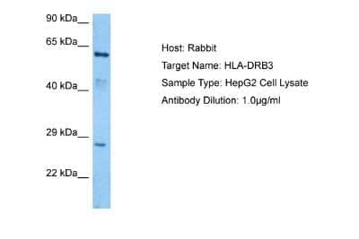 Western Blot: HLA DRB3 Antibody [NBP2-82249]