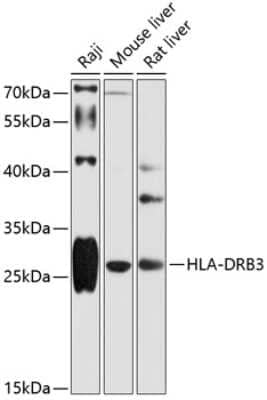 Western Blot: HLA DRB3 AntibodyBSA Free [NBP3-03660]