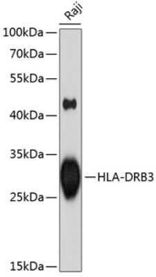 Western Blot: HLA DRB3 AntibodyBSA Free [NBP3-03661]