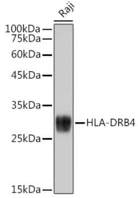 Western Blot: HLA DRB4 Antibody (3Z5V9) [NBP3-15265]