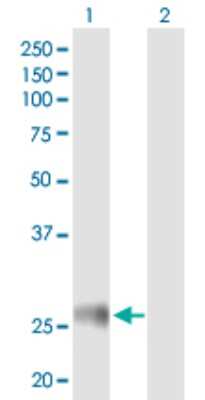 Western Blot: HLA DRB4 Antibody [H00003126-B01P]