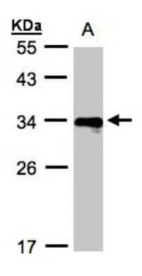 Western Blot: HLA DRB4 Antibody [NBP1-32553]