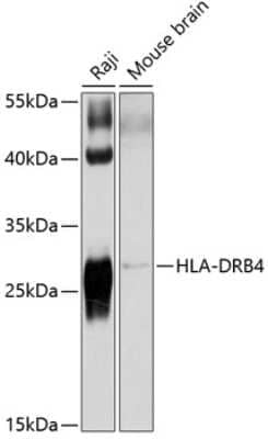 Western Blot: HLA DRB4 AntibodyBSA Free [NBP3-03662]