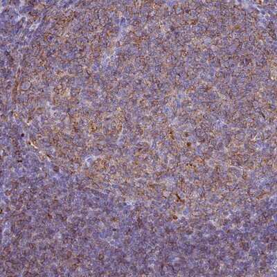 Immunohistochemistry-Paraffin: HLA DRB5 Antibody [NBP2-14093]
