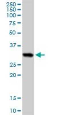 Western Blot: HLA DRB5 Antibody [H00003127-D01P]