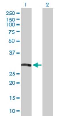 Western Blot: HLA DRB5 Antibody [H00003127-D01P]
