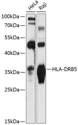 Western Blot: HLA DRB5 AntibodyAzide and BSA Free [NBP3-03663]