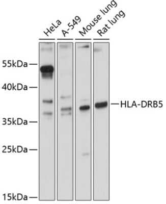 Western Blot: HLA DRB5 AntibodyAzide and BSA Free [NBP3-03664]