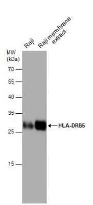 Western Blot: HLA DRB5 Antibody [NBP3-13003]