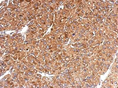 Immunohistochemistry-Paraffin: HLA-E Antibody [NBP2-14985]
