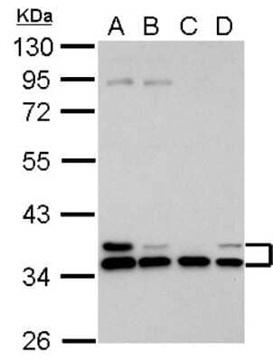 Western Blot: HLA-E Antibody [NBP2-14985]