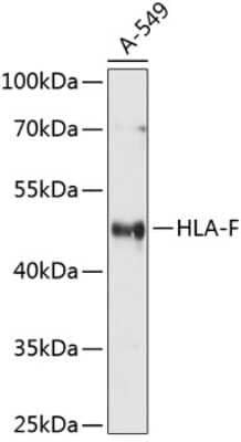 Western Blot: HLA F AntibodyBSA Free [NBP3-03583]