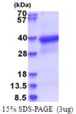 SDS-PAGE: Recombinant Human HLA F His Protein [NBP2-51744]