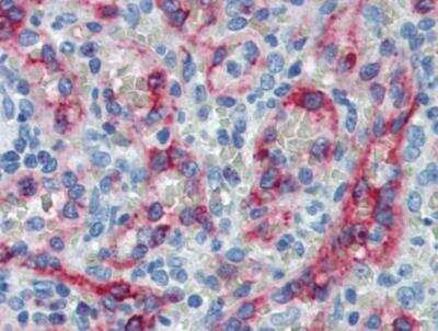 Immunohistochemistry-Paraffin: HLA G Antibody (4H84) - BSA Free [NB110-55297]