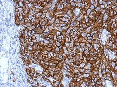 Immunohistochemistry-Paraffin: HLA G Antibody [NBP2-16855]