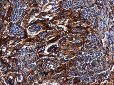 Immunohistochemistry-Paraffin: HLA G Antibody [NBP2-16855]