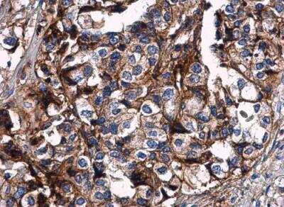 Immunohistochemistry-Paraffin: HLA G Antibody [NBP2-16855]