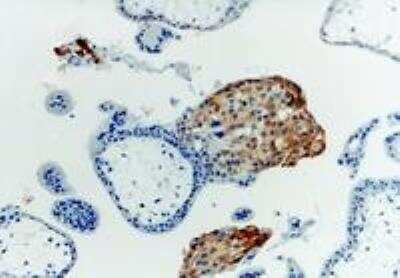 Immunohistochemistry: HLA G Antibody (MEM-G/1) - BSA Free [NB500-302]