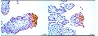 Immunohistochemistry: HLA G Antibody (MEM-G/1) - BSA Free [NB500-302]