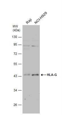 Western Blot: HLA G Antibody [NBP2-16855]