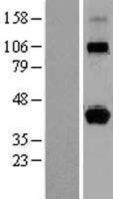 Western Blot: HLA G Overexpression Lysate [NBL1-11592]