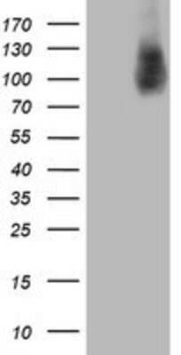 Western Blot: HLCS Antibody (OTI1E4) [NBP2-01859]