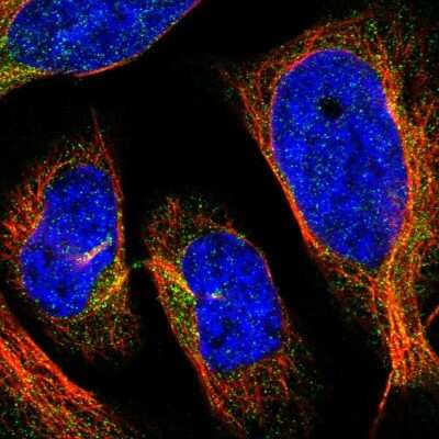 Immunocytochemistry/ Immunofluorescence: HLCS Antibody [NBP1-81759]