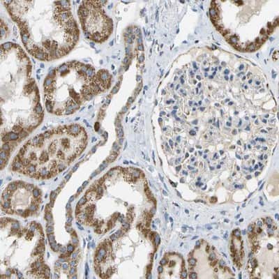Immunohistochemistry-Paraffin: HLCS Antibody [NBP1-81759]