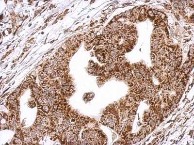 Immunohistochemistry-Paraffin: HLCS Antibody [NBP2-16856]
