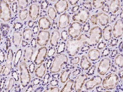 Immunohistochemistry-Paraffin: HLCS Antibody [NBP2-97225]