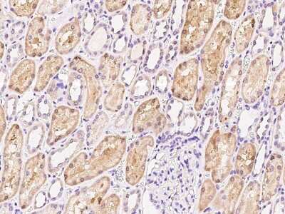 Immunohistochemistry-Paraffin: HLCS Antibody [NBP2-99591]