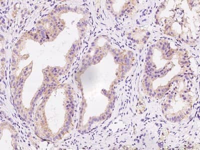 Immunohistochemistry-Paraffin: HLCS Antibody [NBP2-99591]