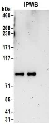 Immunoprecipitation: HLCS Antibody [NBP2-32174]