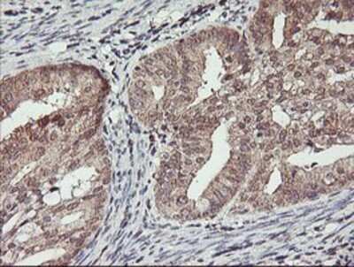 Immunohistochemistry: HLCS Antibody (OTI1E4) - Azide and BSA Free [NBP2-70893]