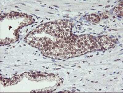Immunohistochemistry: HLCS Antibody (OTI1E4) - Azide and BSA Free [NBP2-70893]