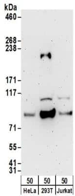 Western Blot: HLCS Antibody [NBP2-32174]