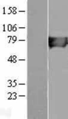 Western Blot: HLCS Overexpression Lysate [NBL1-11597]