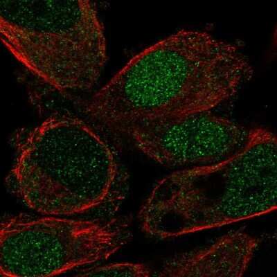 Immunocytochemistry/ Immunofluorescence: HLF Antibody [NBP2-56606]