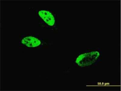 Immunocytochemistry/ Immunofluorescence: HLF Antibody (M2) [H00003131-M04]