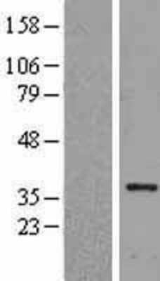 Western Blot: HLF Overexpression Lysate [NBL1-11598]